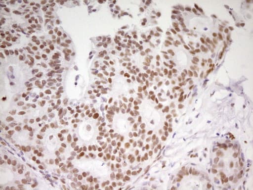 Monoclonal Mouse anti-Human MEF2D Antibody (clone OTI1E11, aa1-282, IHC, WB)