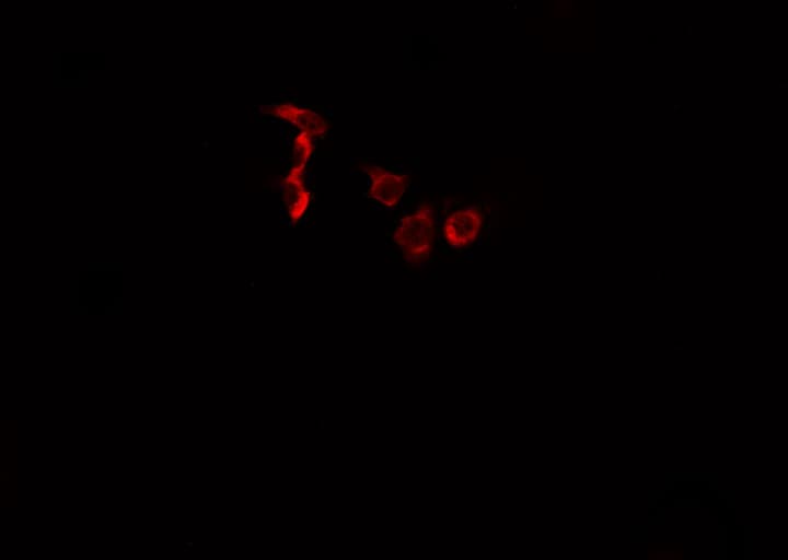 Polyclonal Rabbit anti-Human EPHA2 / EPH Receptor A2 Antibody (phospho-Tyr588,phospho-Tyr596, IF, WB)