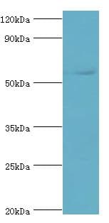 Polyclonal Rabbit anti-Human GRB7 Antibody (aa233-532, IHC, WB)