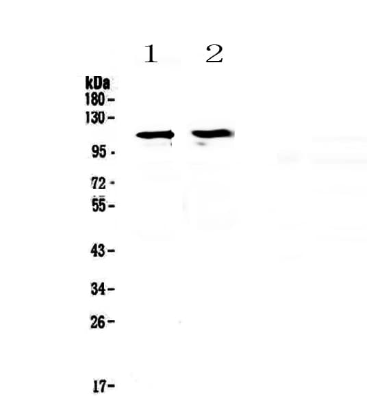 Polyclonal Rabbit anti-Human STAT2 Antibody (WB)