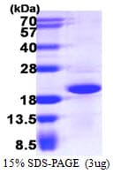 Human CRCP / CGRP Receptor Component Protein (Recombinant His)