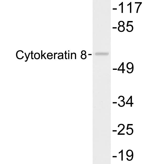 PathPlus™ KRT8 / CK8 / Cytokeratin 8 Antibody (aa25-74)