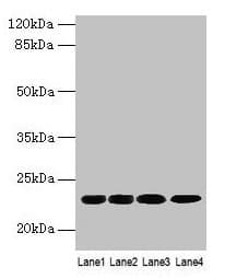 Polyclonal Rabbit anti-Human CBX5 / HP1 Alpha Antibody (IHC, WB)