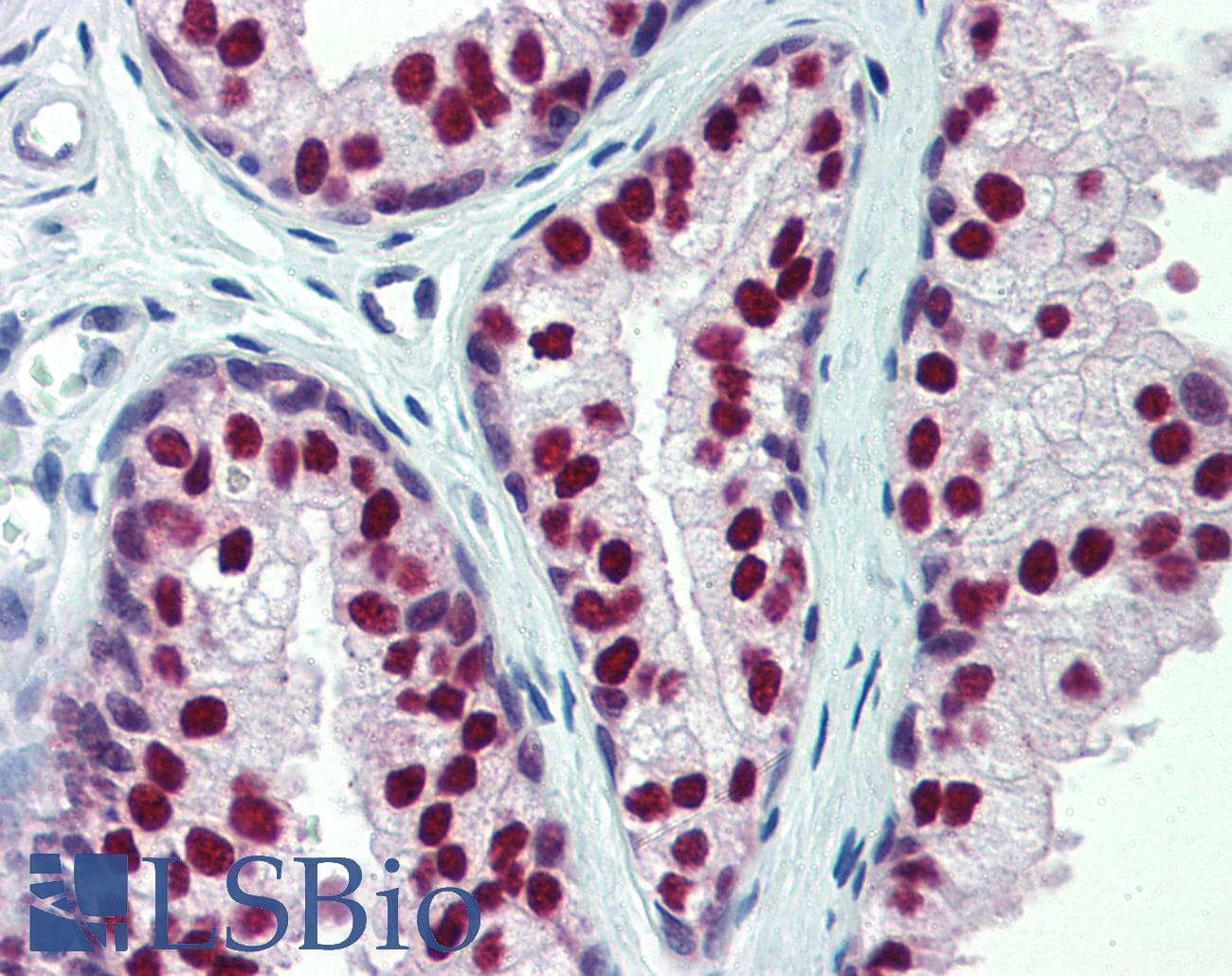 IHC-plus™ Monoclonal Mouse anti-Human CUL9 / Cullin 9 Antibody (clone PO69, IHC, WB)