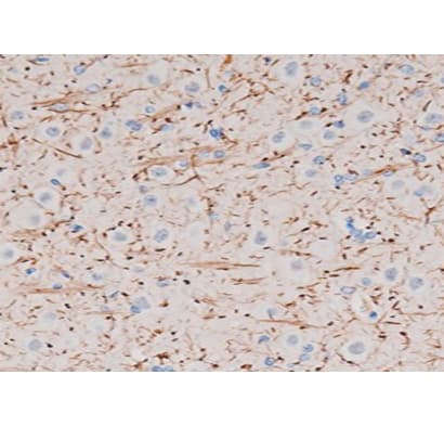 P2RY12 / P2Y12 Antibody