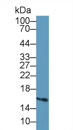 E-FABP / FABP5 Antibody (aa1-132)
