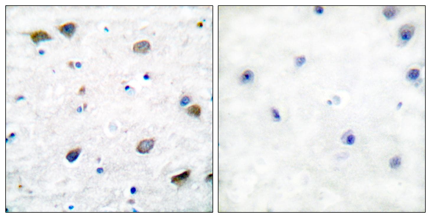 Polyclonal Rabbit anti-Human GABRB1 Antibody (Ab-434, IHC)