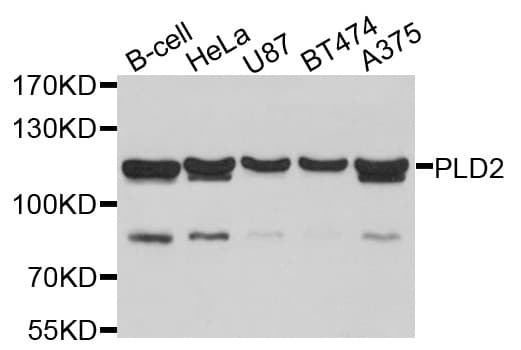 PLD2 / Phospholipase D2 Antibody