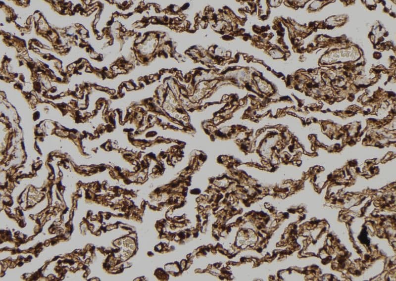 FAM96B Antibody