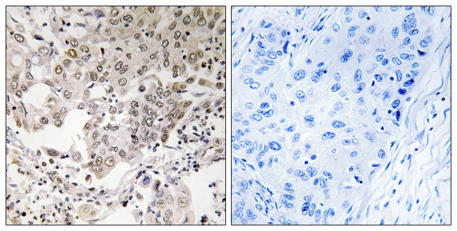 CAP-G2 / MTB Antibody (aa561-610)