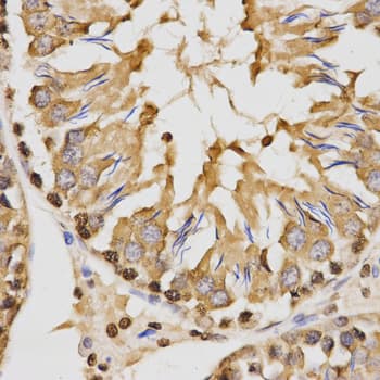 Histone H3 Antibody (Trimethyl-Lys27)
