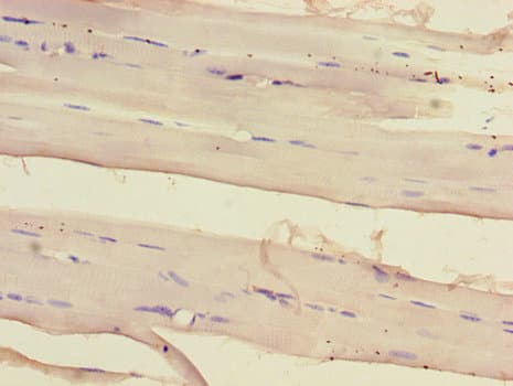 SIRT2 / Sirtuin 2 Antibody