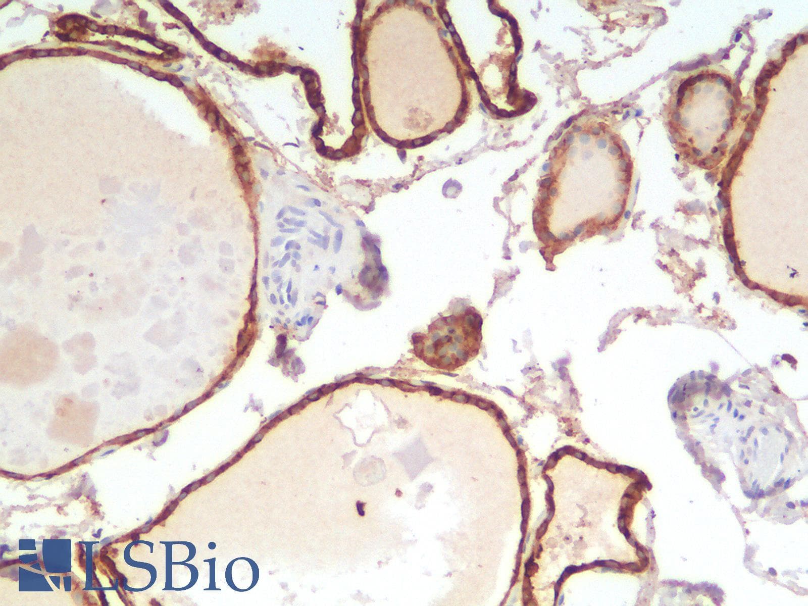 IHC-plus™ Recombinant Monoclonal Rabbit anti-Human EPCAM Antibody (clone EGP40/2041R, aa100-224, IHC, WB)
