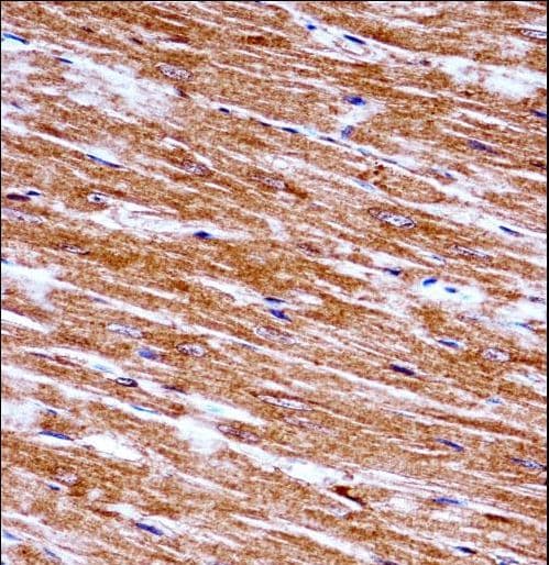 NEK6 Antibody (aa251-280)