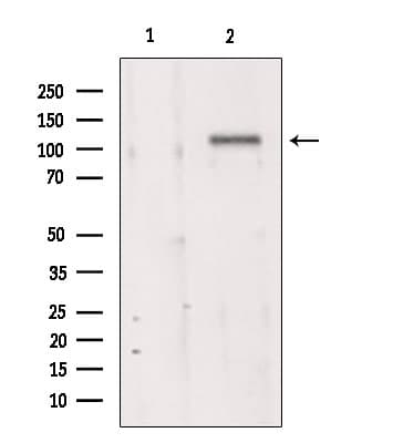 TMEM67 Antibody