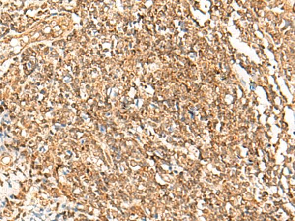 POLH / DNA Polymerase Eta Antibody