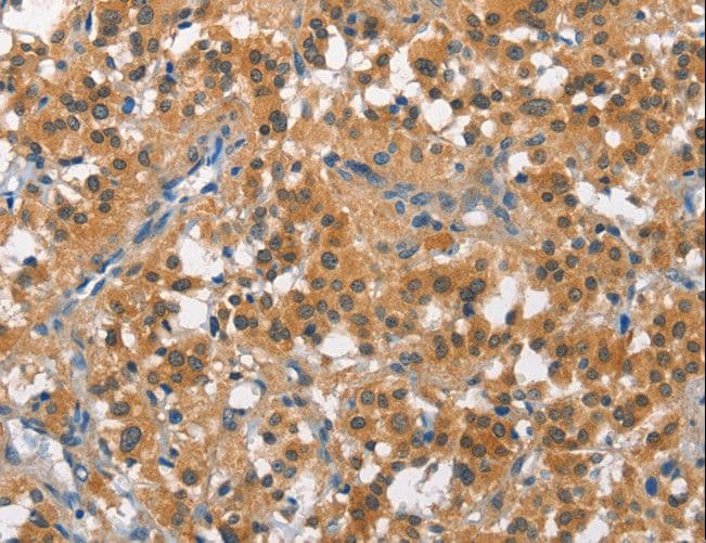 CUL7 Antibody