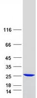 Human RAB24 Protein (Recombinant Myc-DDK (Flag))