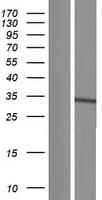 UBC6 / UBE2J2 Protein (Over-Expression Lysate Myc-DDK (Flag))