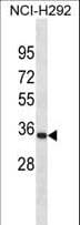 Polyclonal Rabbit anti-Human PRX-1 / PRRX1 Antibody (aa213-242, WB)