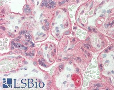 IHC-plus™ PROC / Protein C Antibody (Internal)