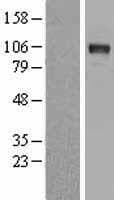 DDR2 Protein (Over-Expression Lysate Myc-DDK (Flag))