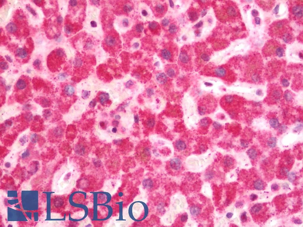 IHC-plus™ Polyclonal Rabbit anti-Human PIK3R4 Antibody (IHC, IF, WB)