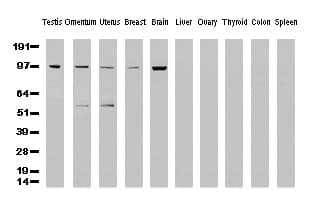 ERCC4 / XPF Antibody (clone UMAB21, Carrier-free)
