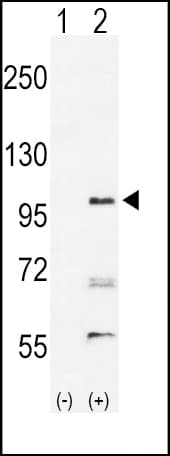 EPHA2 / EPH Receptor A2 Antibody (aa30-60)
