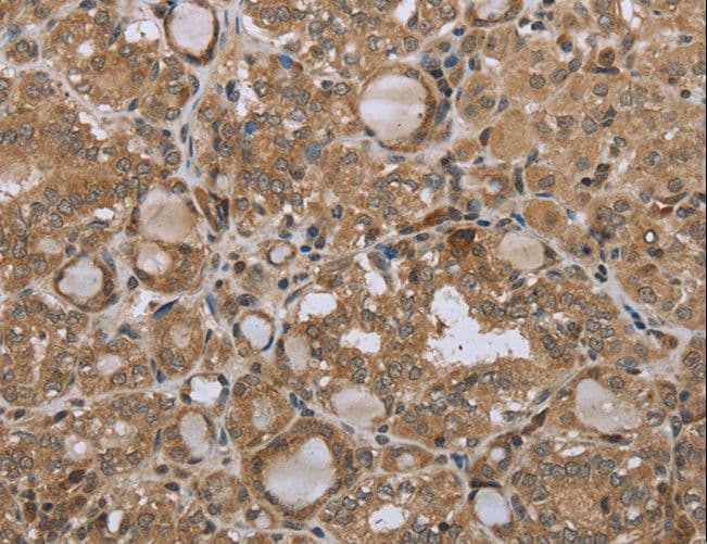 Polyclonal Rabbit anti-Human STMN2 + STMN3 + STMN4 Antibody (IHC)