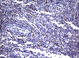 Monoclonal Mouse anti-Human FOXP1 Antibody (clone OTI3G3, IHC)