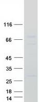 Human CNOT4 / CLONE243 Protein (Recombinant Myc-DDK (Flag))