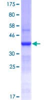 Human SI / Sucrase Isomaltase Protein (Recombinant GST, N-terminus)