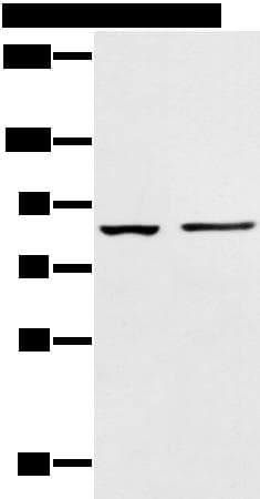 AAK1 Antibody