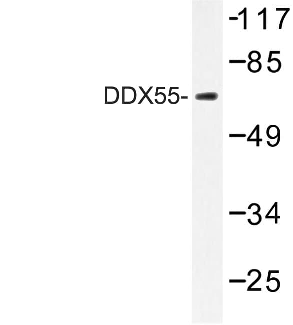 DDX55 Antibody (Gln133)