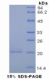 Human MUC5AC Protein (Recombinant His-S)