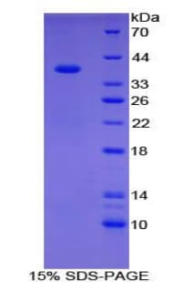 Human CPB / Carboxypeptidase B Protein (Recombinant His-T7)