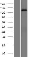 Human DGK-IOTA / DGKI Protein (Over-Expression Lysate Myc-DDK (Flag))
