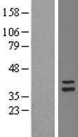TSFM Protein (Over-Expression Lysate Myc-DDK (Flag))