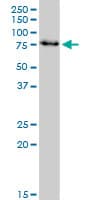 IRAK3 / IRAKM / IRAK-M Antibody (clone 1C9)