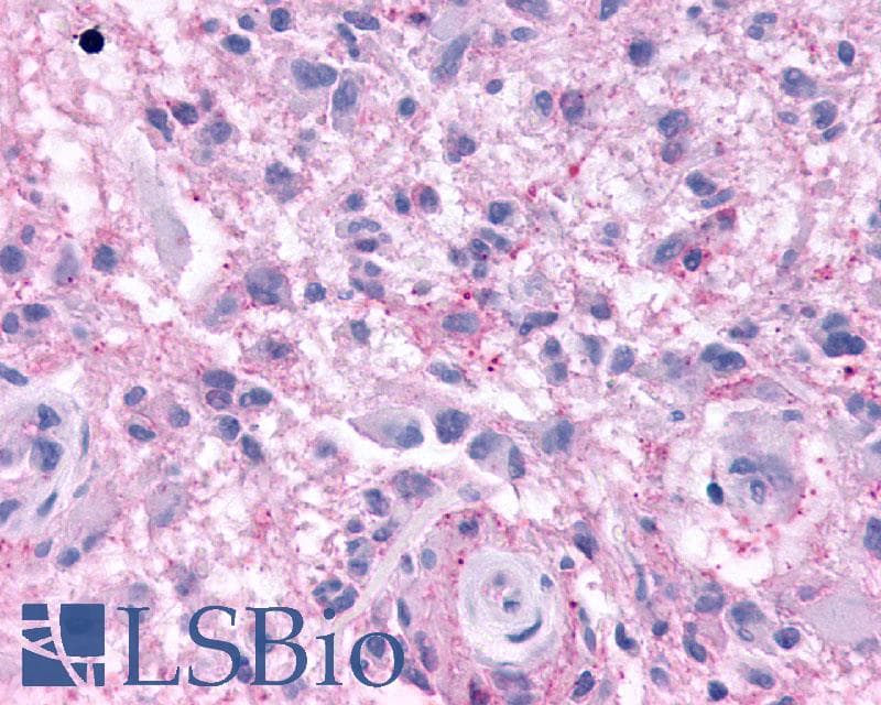 PathPlus™ KISS1R / GPR54 Antibody (N-Terminus)