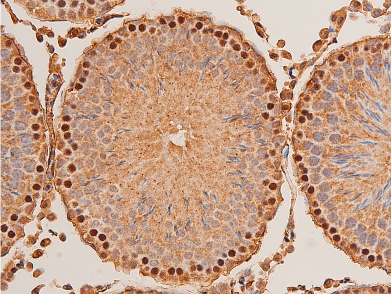 Polyclonal Rabbit anti-Human CHEK1 / CHK1 Antibody (phospho-Ser296, IHC, IF, WB)