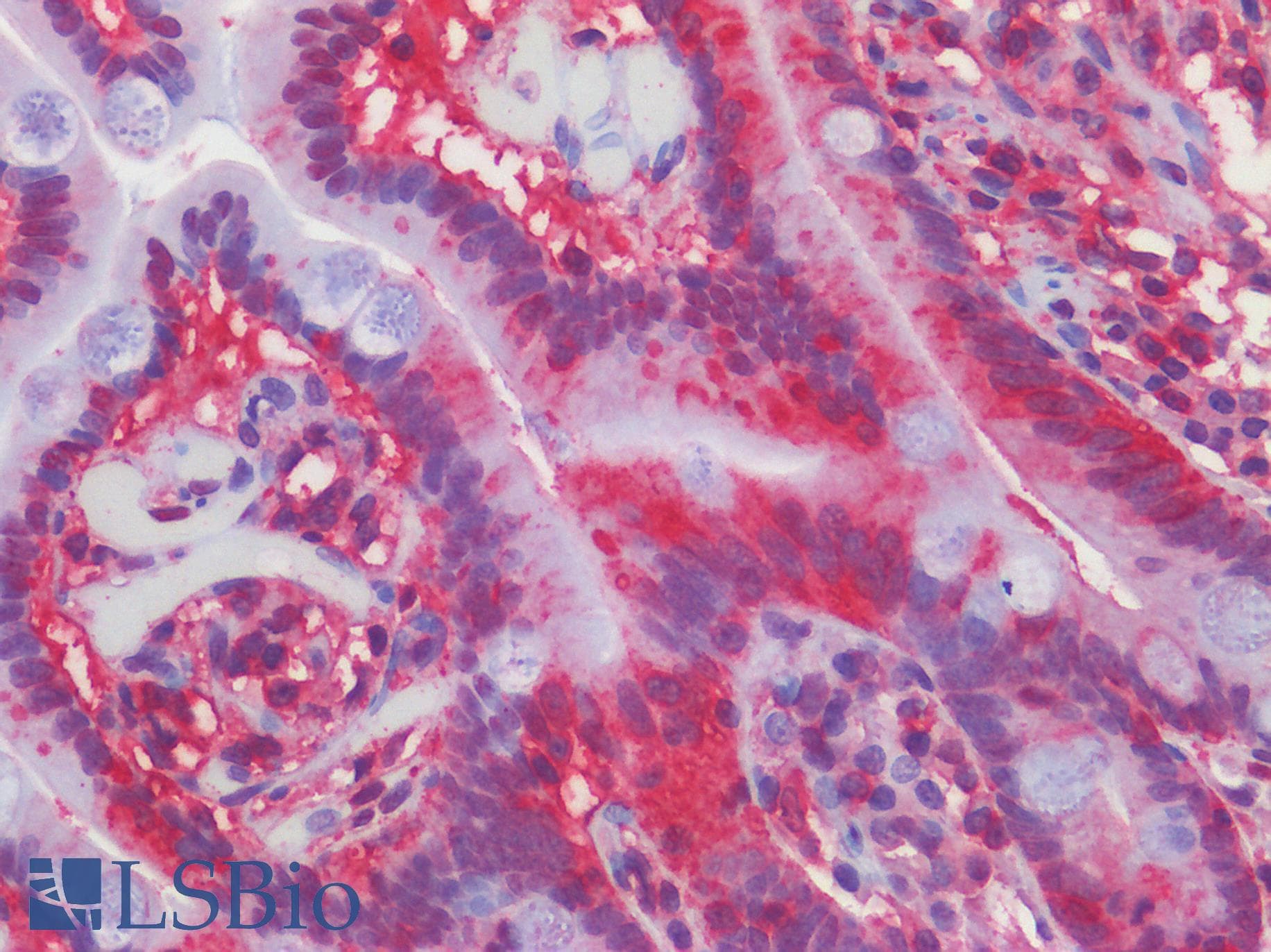 IHC-plus™ SMO / Smoothened Antibody (aa68-117)
