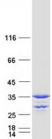 Human MMACHC Protein (Recombinant Myc-DDK (Flag))