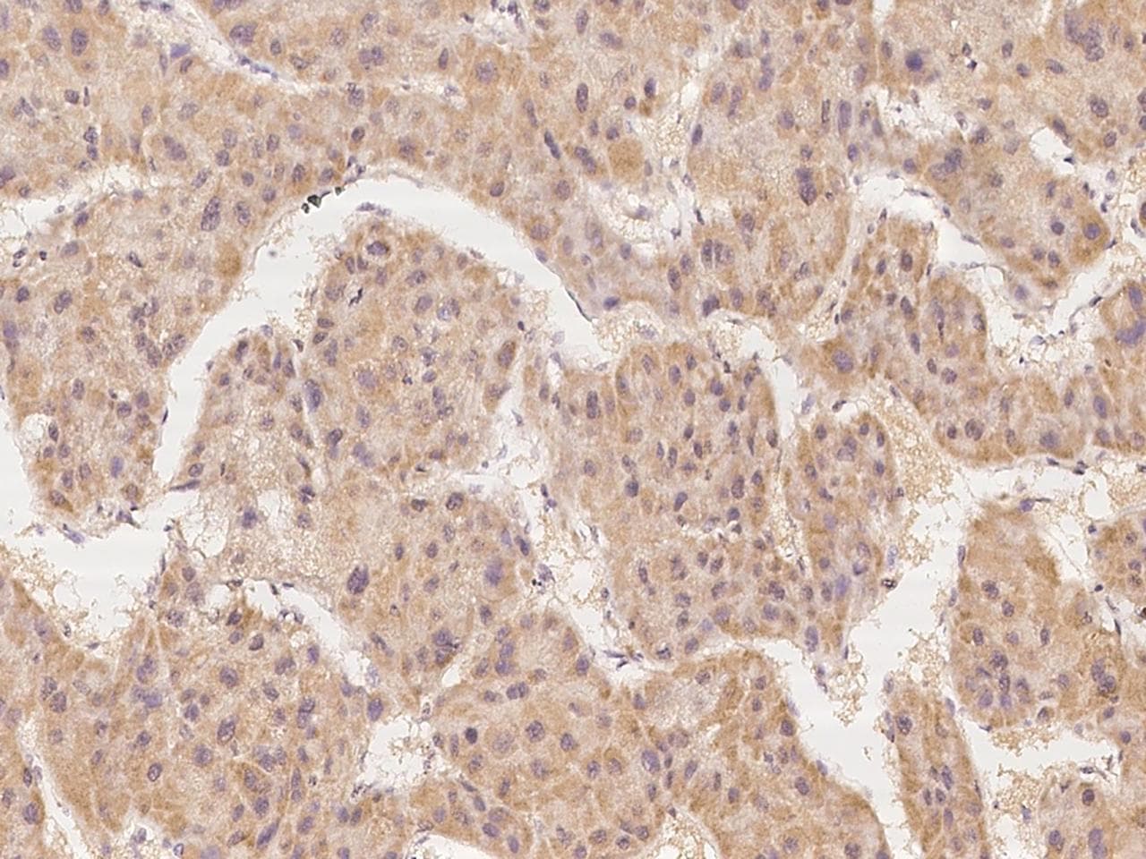 SPATA6 / SRF-1 Antibody