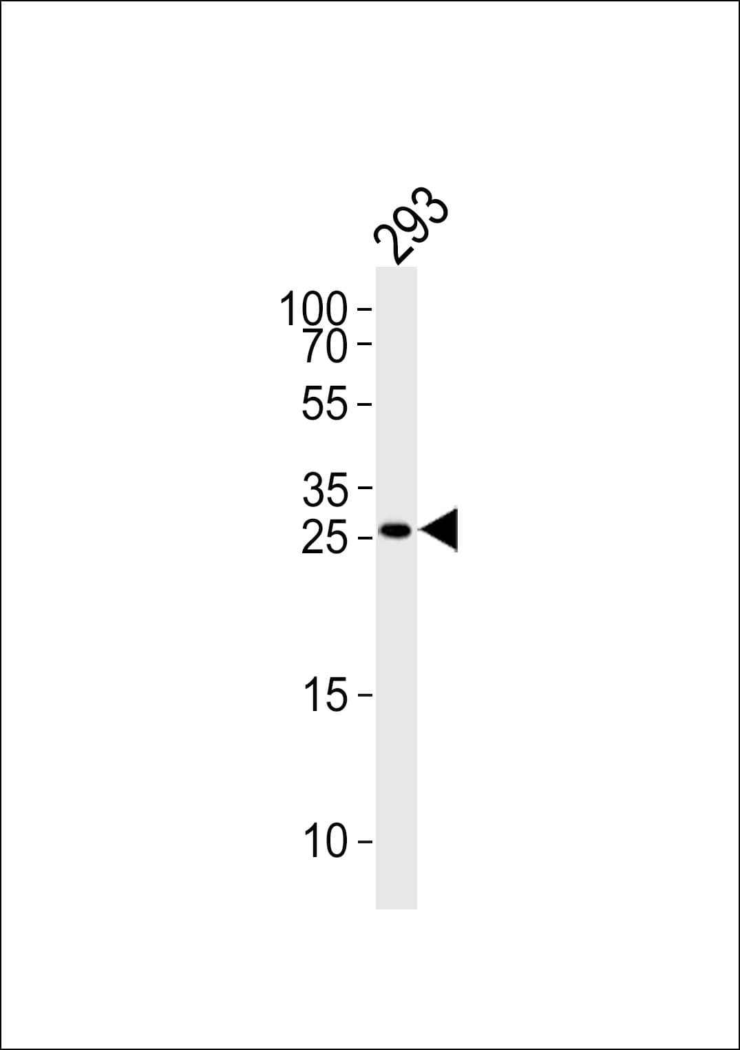 IHC-plus™ TGIF2 Antibody (aa171-199)