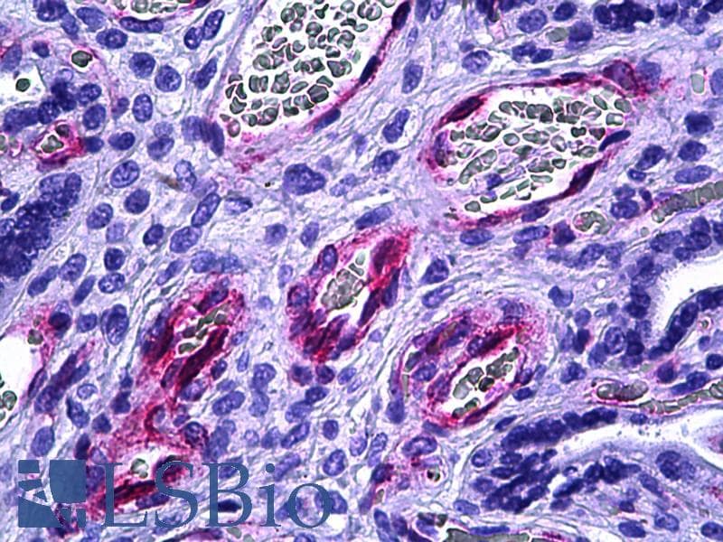 IHC-plus™ ETK / BMX Antibody (aa11-60)