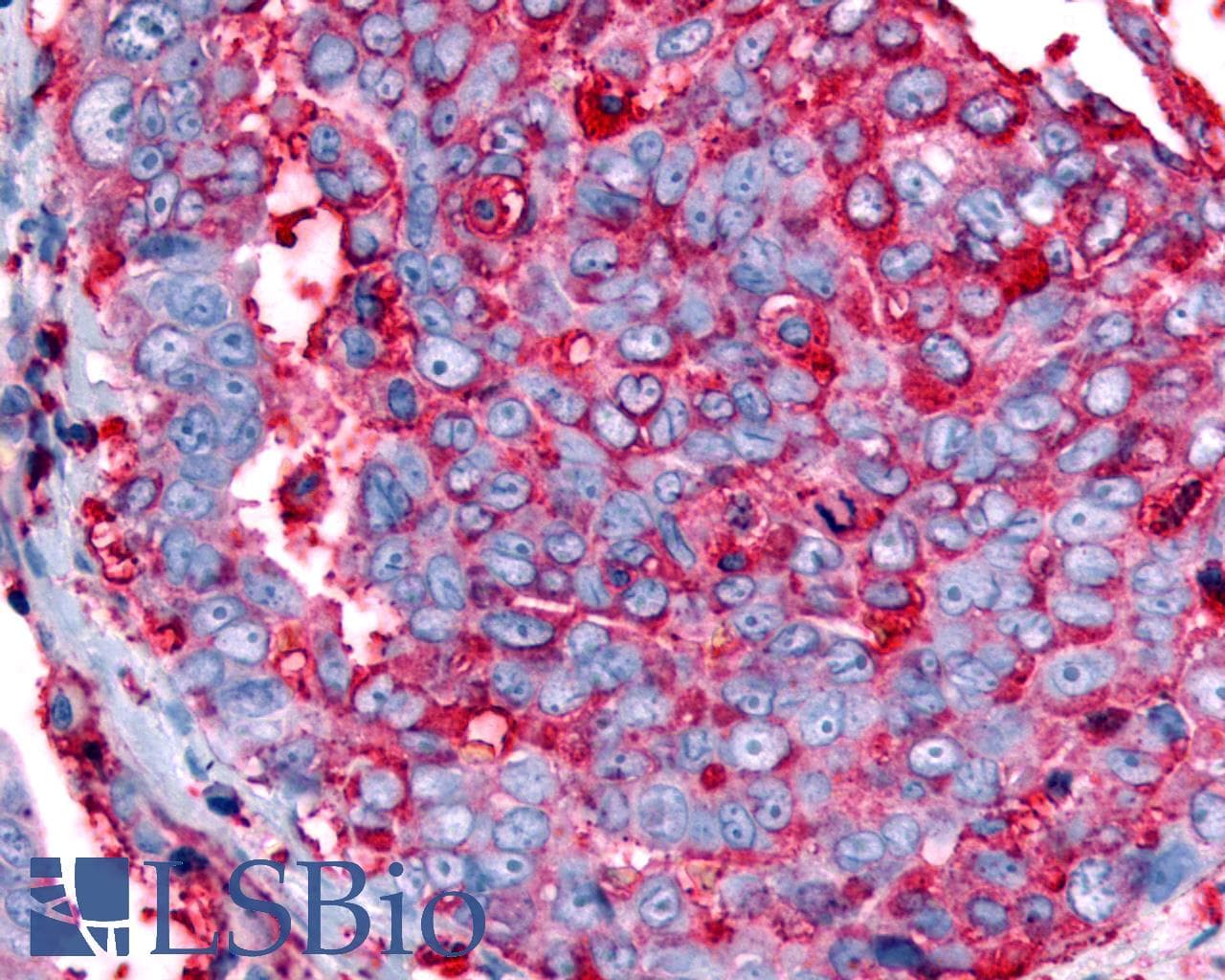 IHC-plus™ Polyclonal Rabbit anti-Human GPR63 Antibody (Cytoplasmic Domain, IHC)