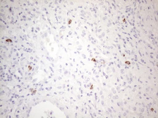 Monoclonal Mouse anti-Human c-Kit / CD117 Antibody (clone OTI2B12, aa27-308, IHC, WB)