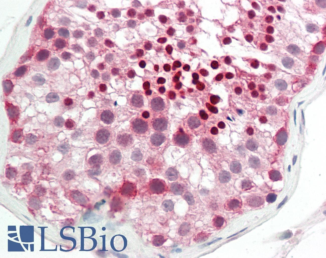 Polyclonal Rabbit anti-Human UNC5A Antibody (aa326-375, IHC, WB)